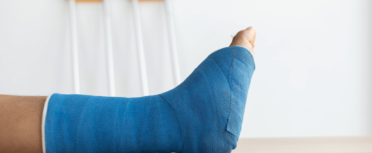 Sprain and Fractures Treatments