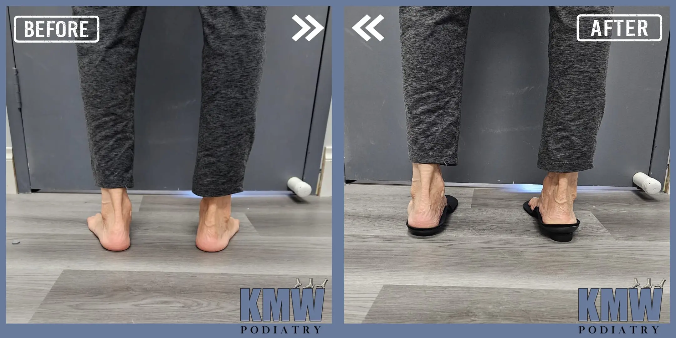 Before and After - KMW Treatments
