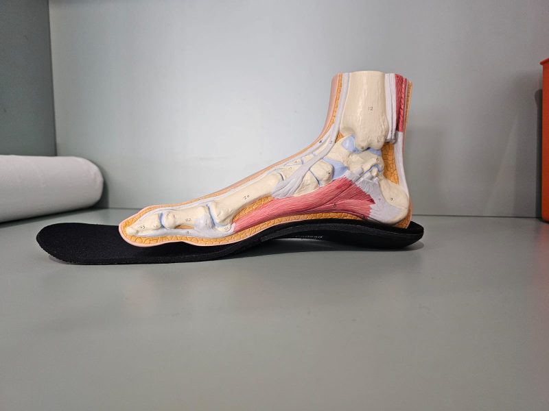 orthotics & insoles KMW (6)